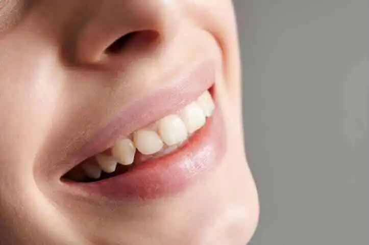 Close-up of a woman's joyful smile showcasing healthy, white teeth.